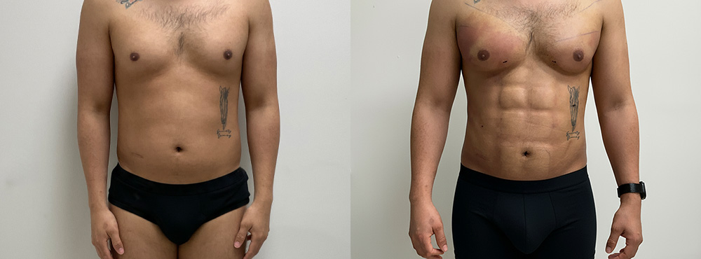 Macho Makeover Before and After