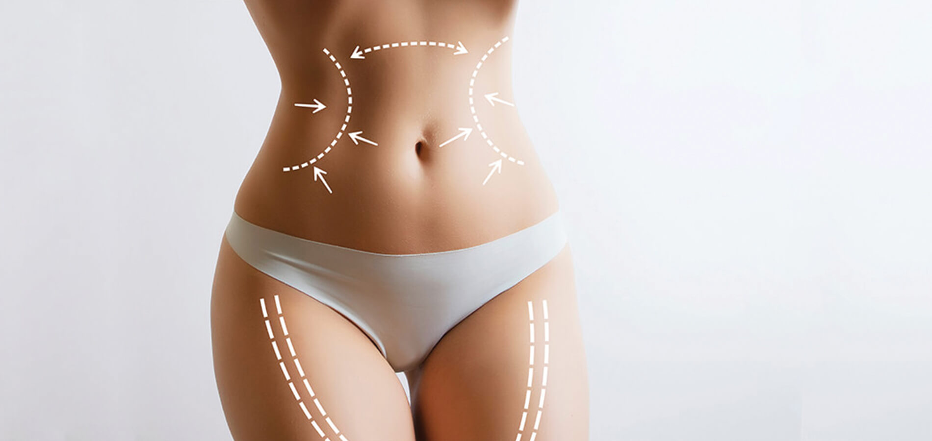 Liposuction and J-Plasma for tightening abdomen