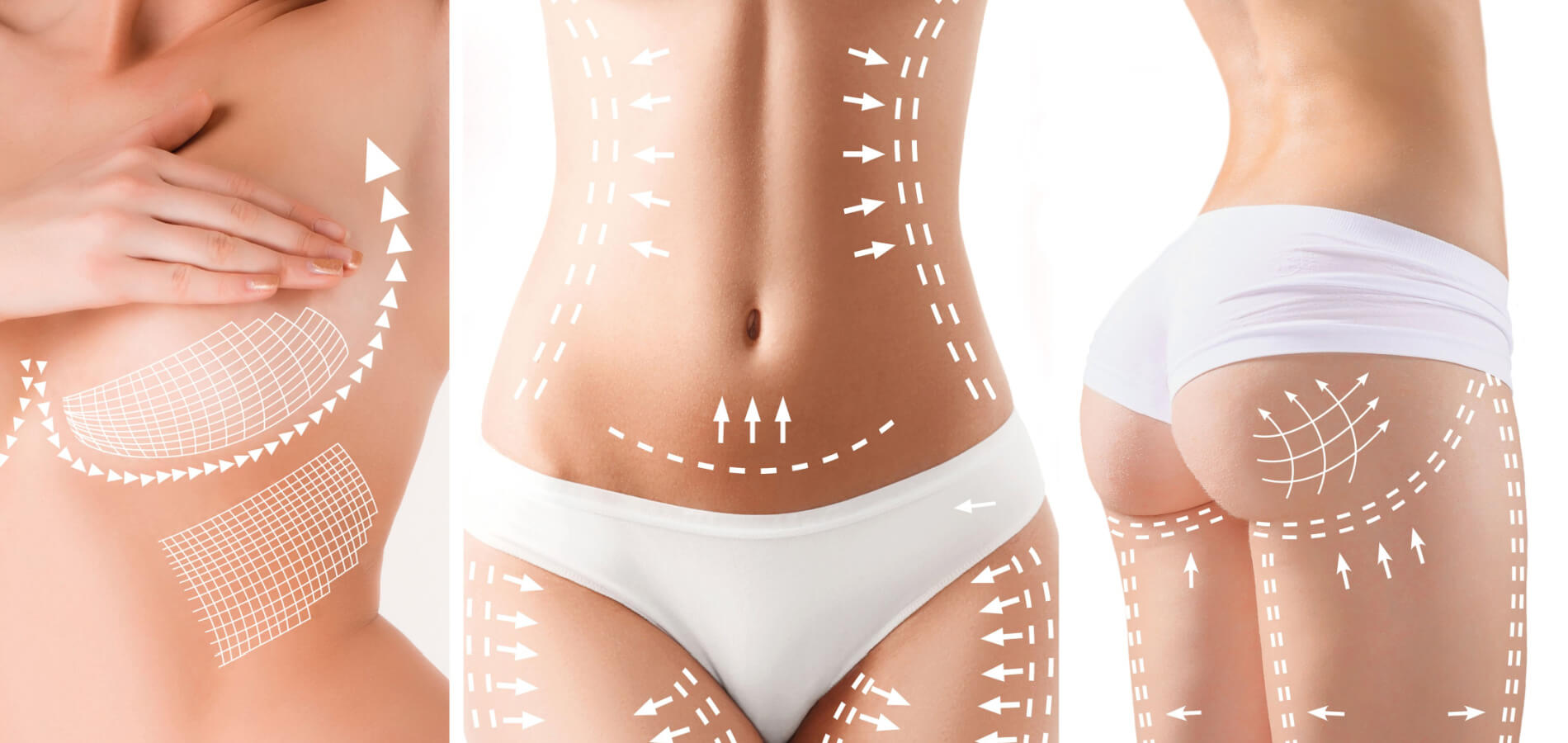 plastic surgery trends for 2020