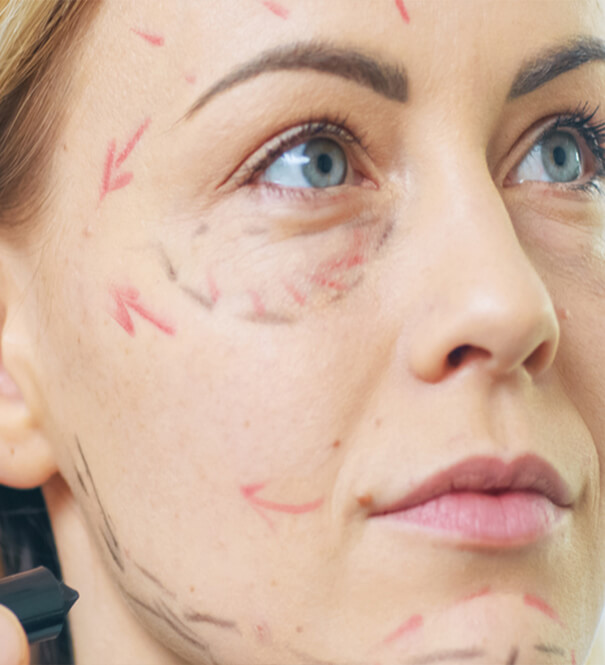 What is the best age for a facelift?