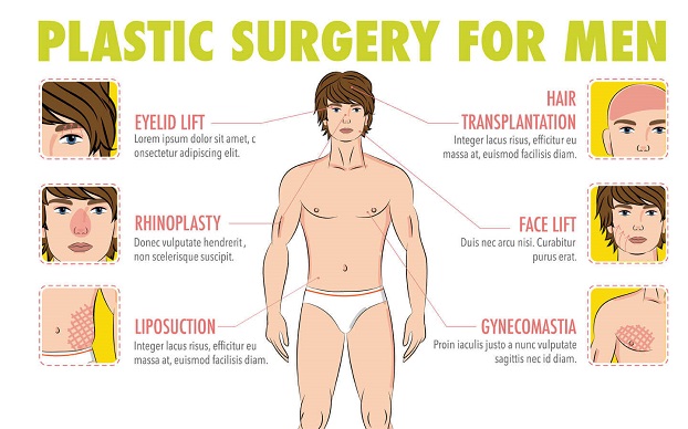 Male Transformations procedures