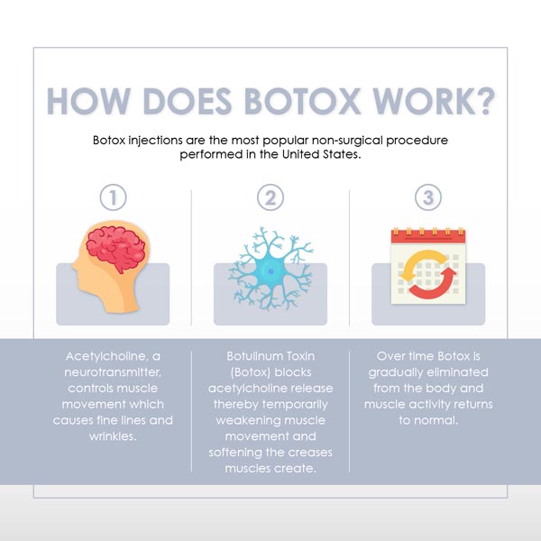Botox injection sites