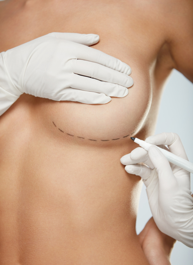 breast implants