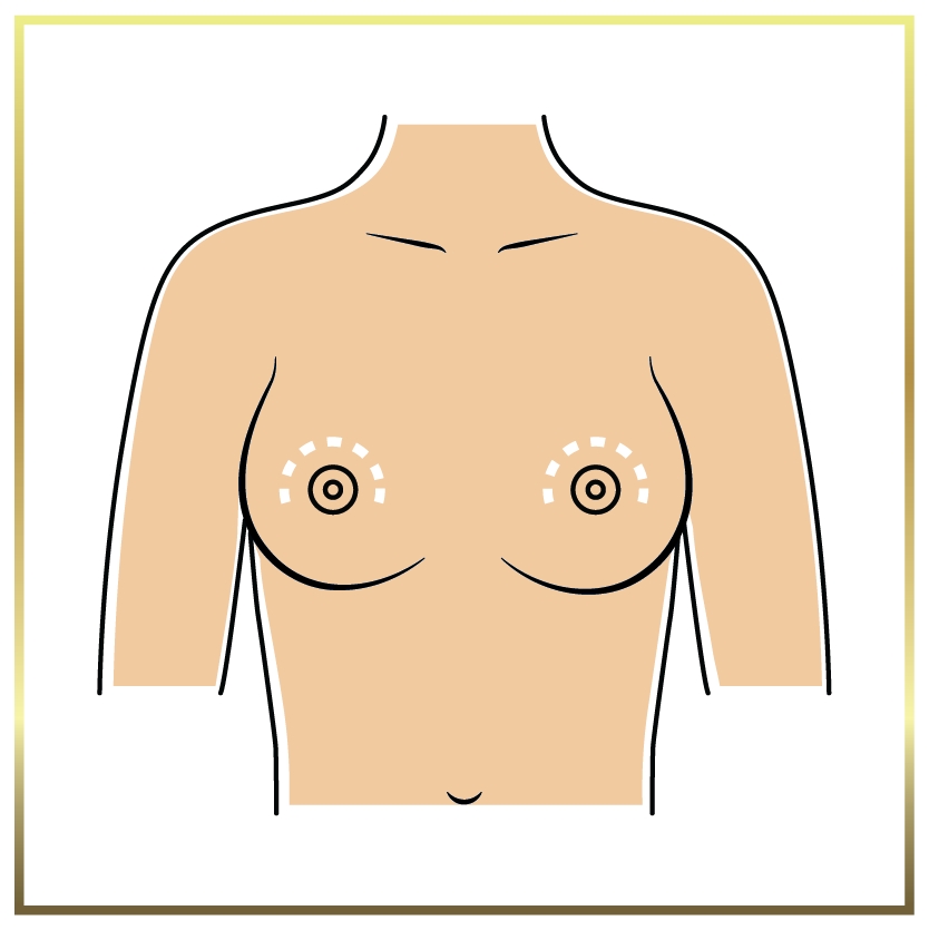 crescent breast lift