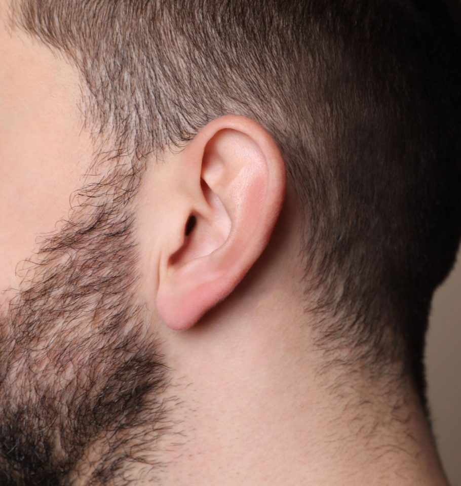 Beneficios de la Otoplastia